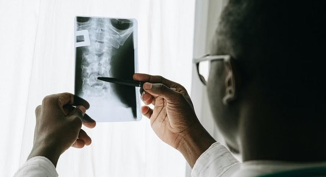 Six Steps to Better Bone Health