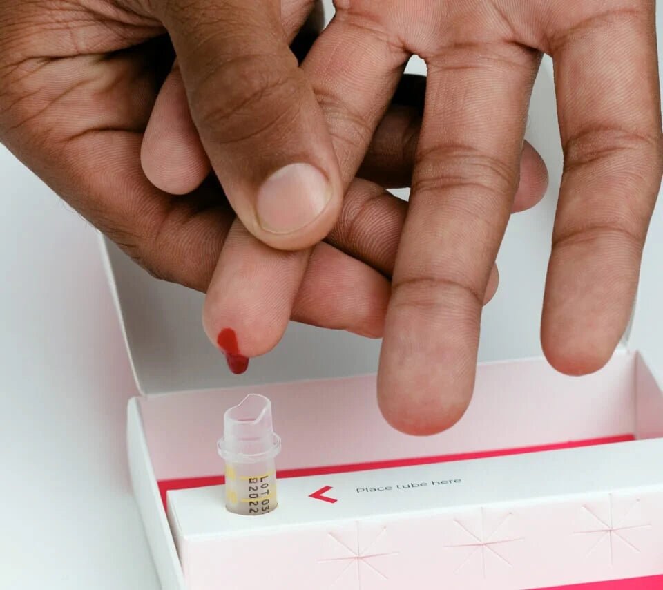 Diabetes (HbA1c) Blood Test